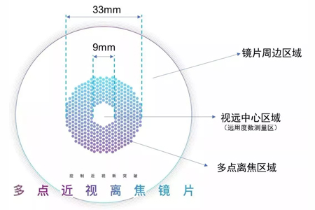 近视离焦眼镜的作用 你真的了解吗？
