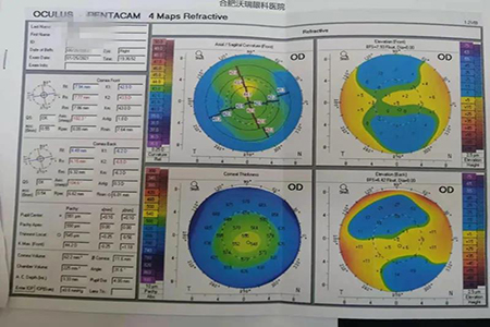 【青少年近视防控】叶黄素护眼糖防控近视是不是真的可以控制近视？