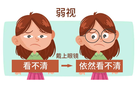 眼睛弱视能治好嘛？