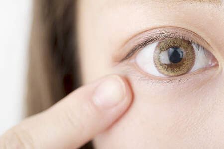 近视手术后流眼泪怎么办?