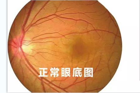 ?沃瑞眼科为您解读全飞秒近视手术的原理是怎样的？