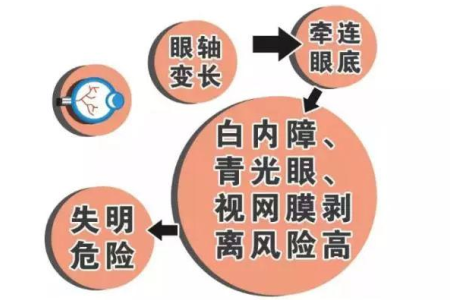 全飞秒近视手术价格哪家好？