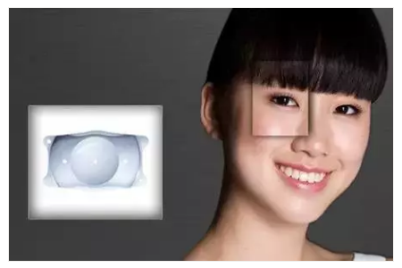 近视眼做了ICL手术要每年复查吗？