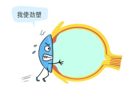 角膜塑形眼镜的效果怎么样？