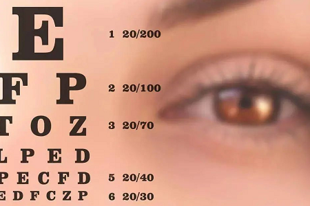 合肥近视眼激光手术价格高不高？