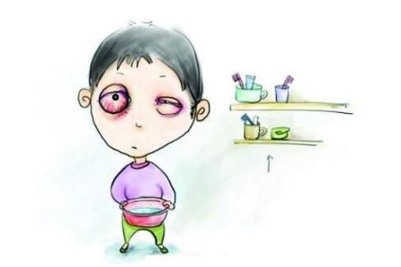 细菌性结膜炎怎么治疗好得快呢？