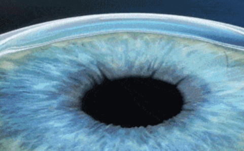 lasek和lasik哪个好呢？